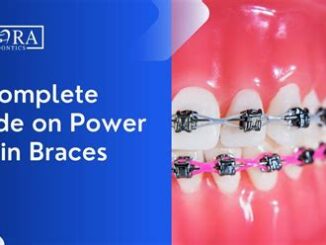 Adjustments: What To Expect With Power Chain Braces