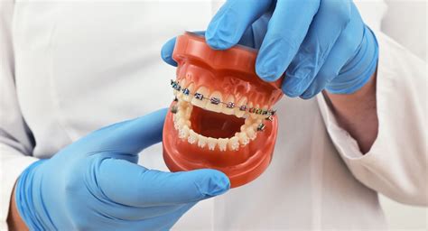 Braces Power Chain For Kids: What Parents Need To Know