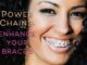 The Evolution Of Power Chains In Orthodontics