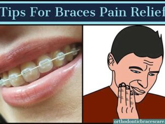Tips For Reducing Pain From Power Chain Braces
